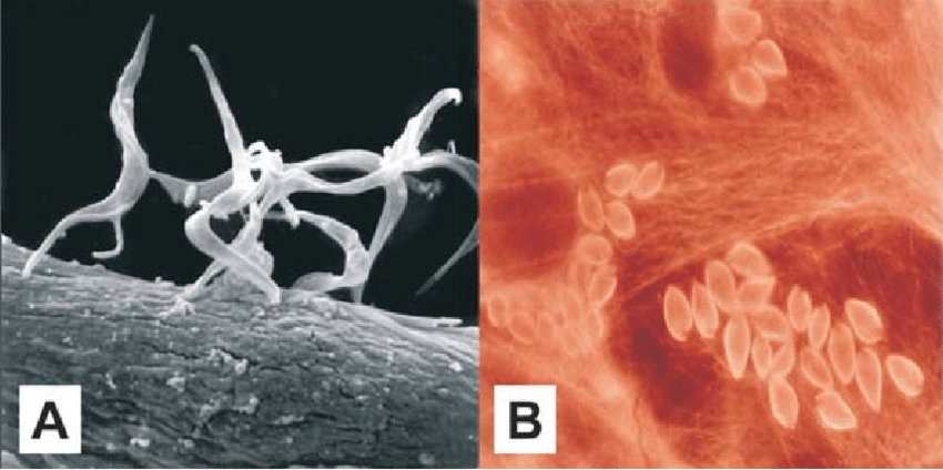 Doença de Chagas