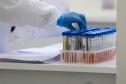 Paraná completa dois anos de pandemia da Covid-19 neste sábado