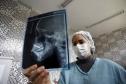 Unidade do Estado especializada em malformação facial retoma 100% da capacidade de atendimento