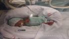 Saúde reforça importância de pais de bebês prematuros permanecerem na UTI