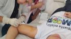 Estado amplia capacitação e implante contraceptivo chega a quase 2 mil mulheres no Paraná