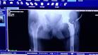 Hospital do Trabalhador realiza cirurgias com transmissão ao vivo 