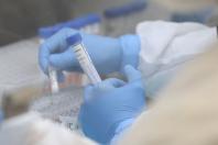 Oito laboratórios estão habilitados para testes do coronavírus