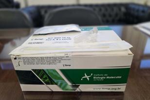 A Secretaria da Saúde do Paraná (Sesa) recebeu um novo lote com 100 mil testes rápidos para detecção de Influenza A, Influenza B e Covid-19. 