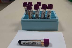 597 mil cadastros: Paraná é o 3º estado com mais doadores de medula óssea no país