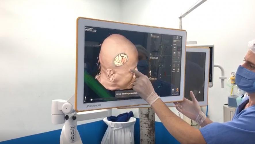Sesa adquire equipamento de ponta para neurocirurugias guiadas; primeira cirurgia foi realizada hoje no Hospital do Trabalhador