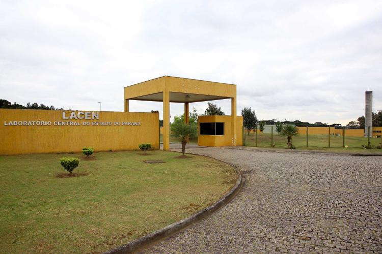 Laboratório Central do Estado inicia testagem para acelerar diagnósticos de Monkeypox