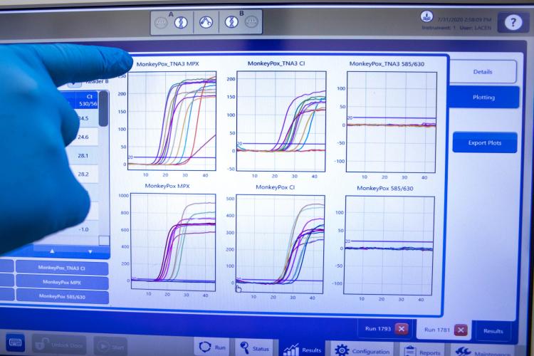 Sesa registra mais 5 casos de Monkeypox