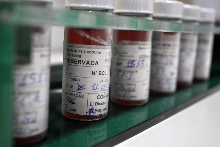 Doação de tecidos ajuda a recuperar queimados, tratar doenças e a devolver a visão