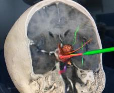 Cirurgia HT