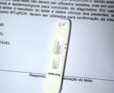 Paraná realiza estratégia de testagem para Covid-19 no aeroporto internacional Afonso Pena