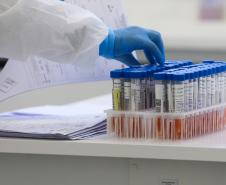 Paraná completa dois anos de pandemia da Covid-19 neste sábado