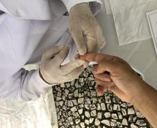 Sesa promove ações para diagnóstico precoce e prevenção do HIV/AIDS no Dezembro Vermelho 