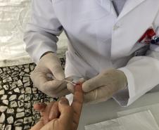 Sesa promove ações para diagnóstico precoce e prevenção do HIV/AIDS no Dezembro Vermelho 