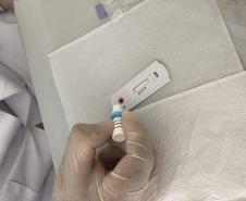 Sesa promove ações para diagnóstico precoce e prevenção do HIV/AIDS no Dezembro Vermelho 