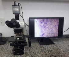 Exame para a detecção do câncer de colo de útero é disponibilizado gratuitamente no Paraná