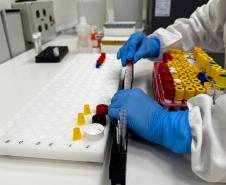 Diferentes métodos e tecnologia: saiba como são confirmados os casos de dengue no Paraná