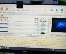 Hospital Regional do Sudoeste inicia testes da UTI Neonatal Neurológica, pioneira na rede