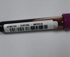 Fevereiro Laranja: mês da conscientização sobre leucemia reforça importância do diagnóstico