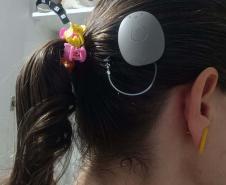 Paraná assume liderança nacional em implantes de correção auditiva pelo SUS