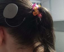 Paraná assume liderança nacional em implantes de correção auditiva pelo SUS