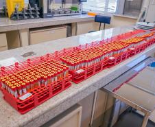 Hemepar passa a fazer testes sorológicos para aumentar segurança em transplantes