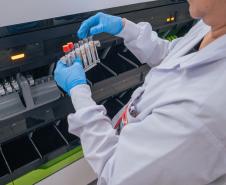 Hemepar passa a fazer testes sorológicos para aumentar segurança em transplantes