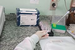 Controle da tuberculose avança no Paraná com aumento de 43% no tratamento preventivo
