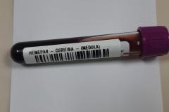 Fevereiro Laranja: mês da conscientização sobre leucemia reforça importância do diagnóstico