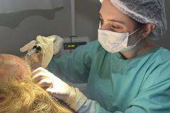 Hospital de Dermatologia Sanitária do Paraná é referência em diagnóstico e tratamento da alopecia