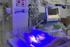 Hospitais públicos do Estado implantam primeiras unidades de UTI Neonatal Neurológica