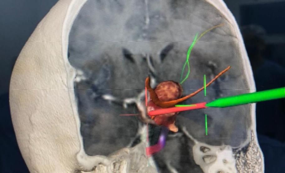 Cirurgia HT