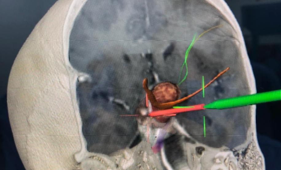Cirurgia HT