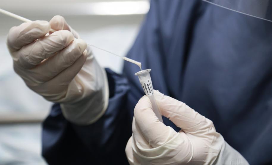 CHT vai incrementar estratégia de testagem Covid-19 em pacientes e colaboradores