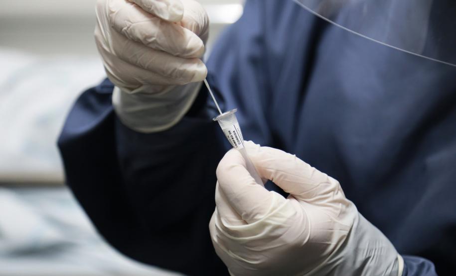 Mais de 786 mil testes para diagnóstico da Covid-19 devem chegar ao Paraná