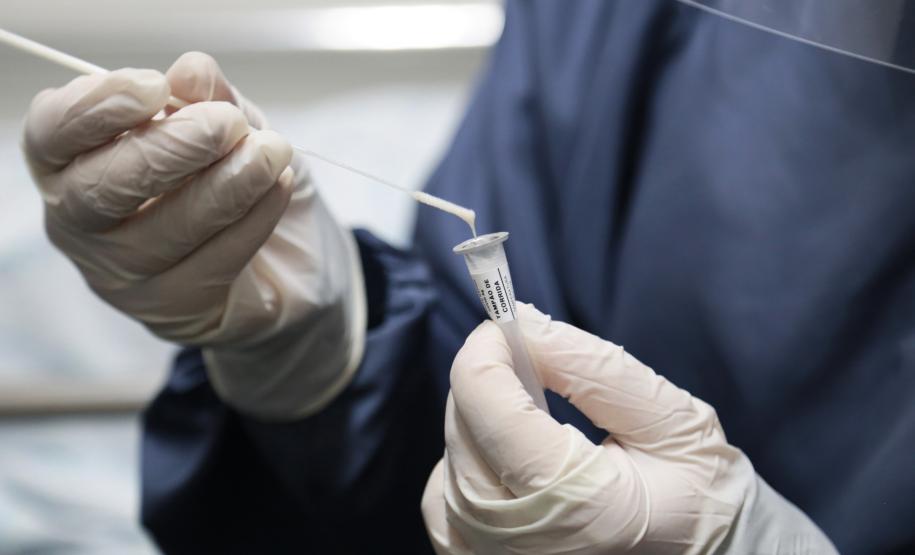 Mais de 786 mil testes para diagnóstico da Covid-19 devem chegar ao Paraná