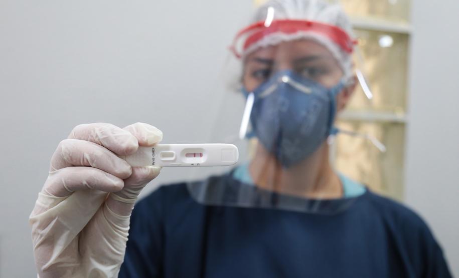Mais de 786 mil testes para diagnóstico da Covid-19 devem chegar ao Paraná