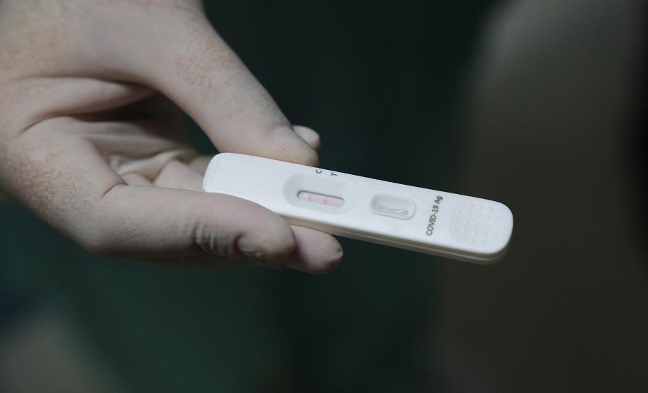 Mais de 786 mil testes para diagnóstico da Covid-19 devem chegar ao Paraná