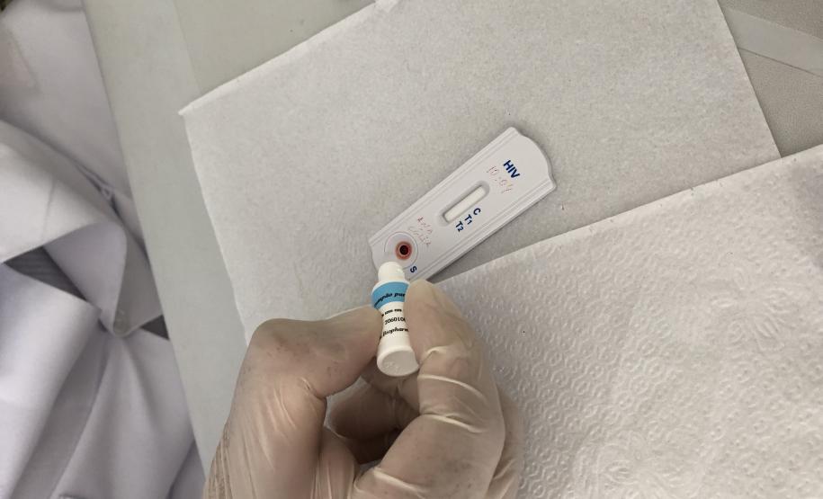 Sesa promove ações para diagnóstico precoce e prevenção do HIV/AIDS no Dezembro Vermelho