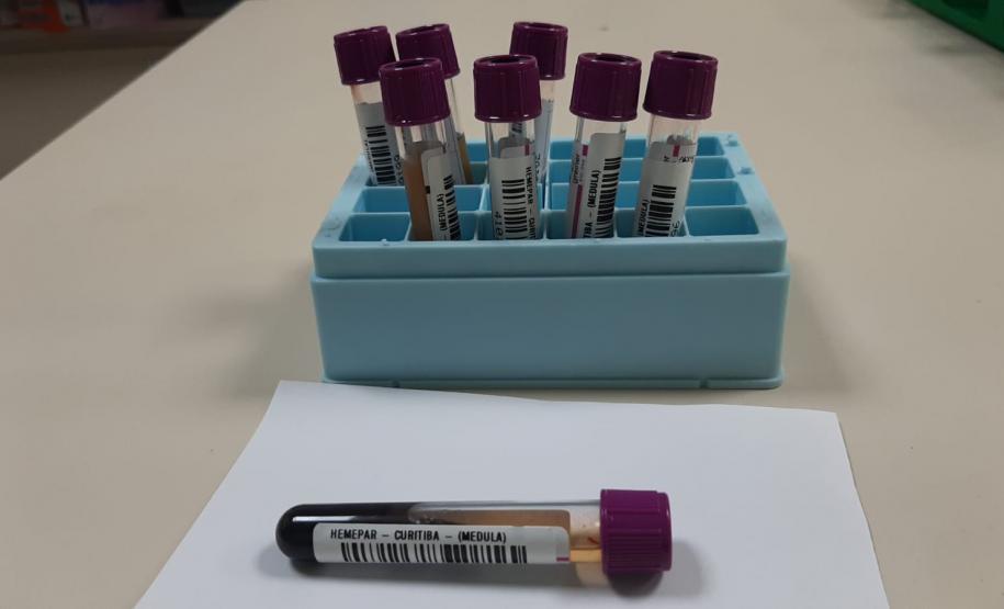 De julho a dezembro, cadastro de medula óssea no Paraná originou seis transplantes bem-sucedidos
