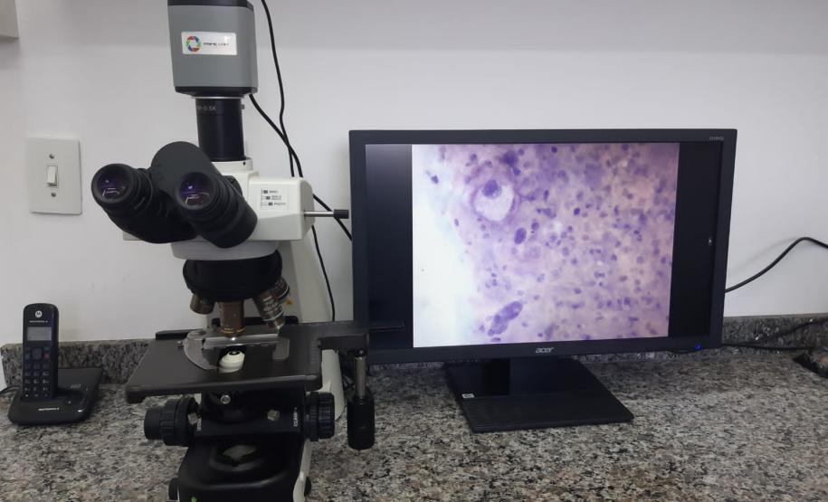 Exame para a detecção do câncer de colo de útero é disponibilizado gratuitamente no Paraná