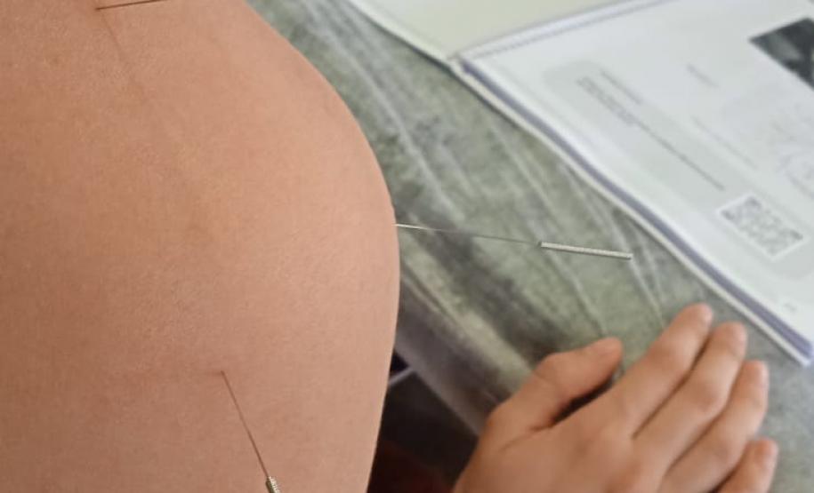 Paraná forma médicos da Atenção Primária para atuar com acupuntura no SUS