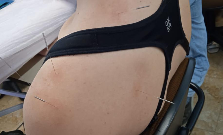 Paraná forma médicos da Atenção Primária para atuar com acupuntura no SUS