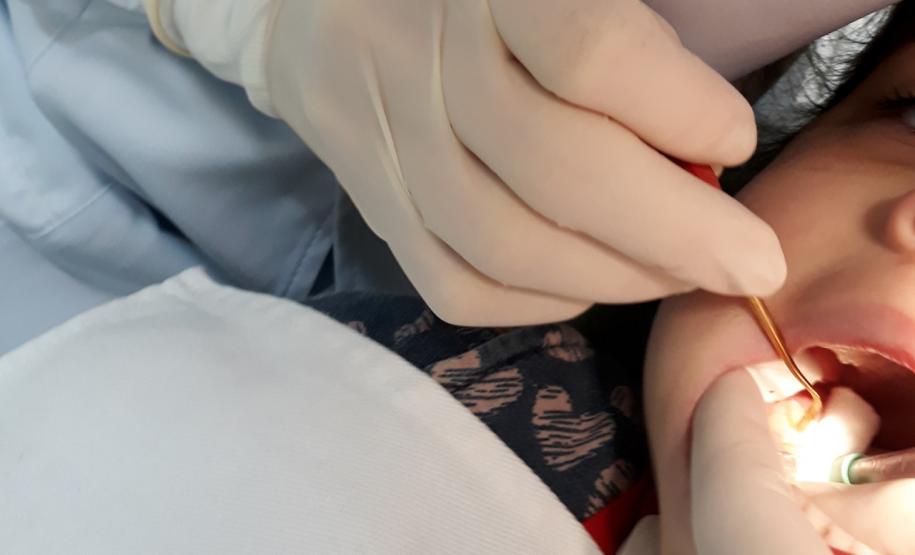 5,6 milhões de consultas: Governo investiu R$ 72 milhões em saúde bucal desde 2019