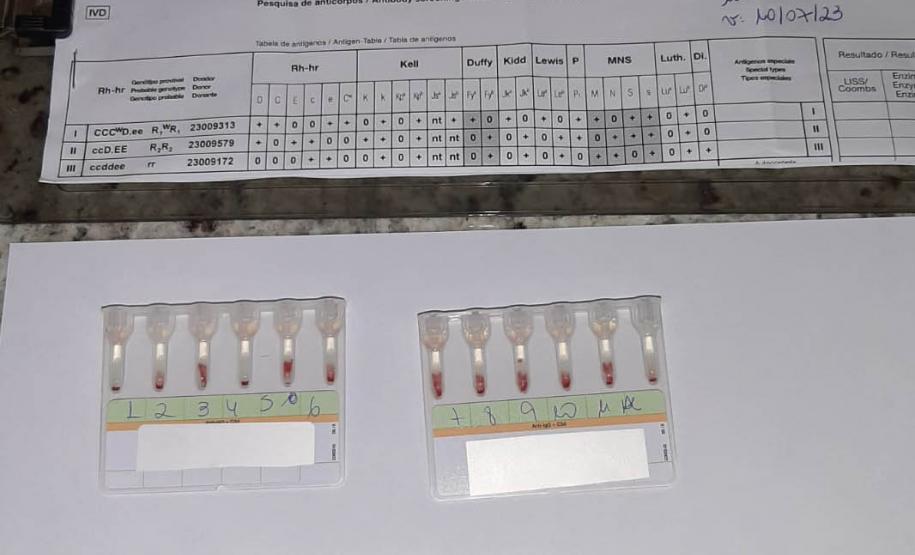 Tratamento ofertado pelo Estado melhora a vida de pacientes com doenças raras do sangue