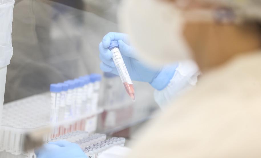 Saúde alerta sobre nova cepa da Covid-19 e reforça medidas preventivas contra a doença