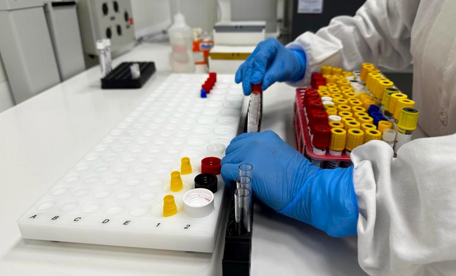 Diferentes métodos e tecnologia: saiba como são confirmados os casos de dengue no Paraná