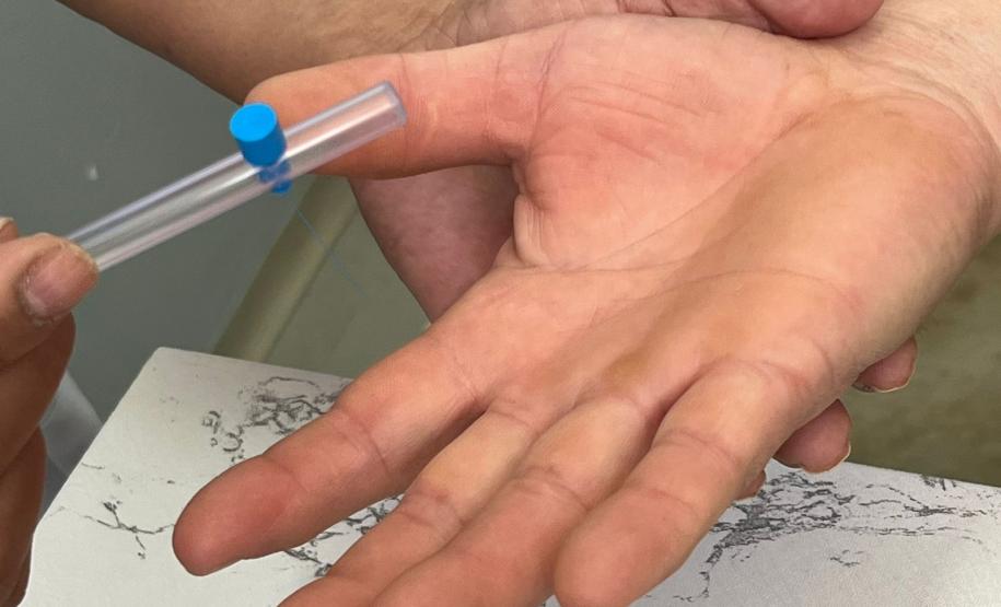 Estado reforça atenção para diagnóstico da hanseníase e luta contra o preconceito