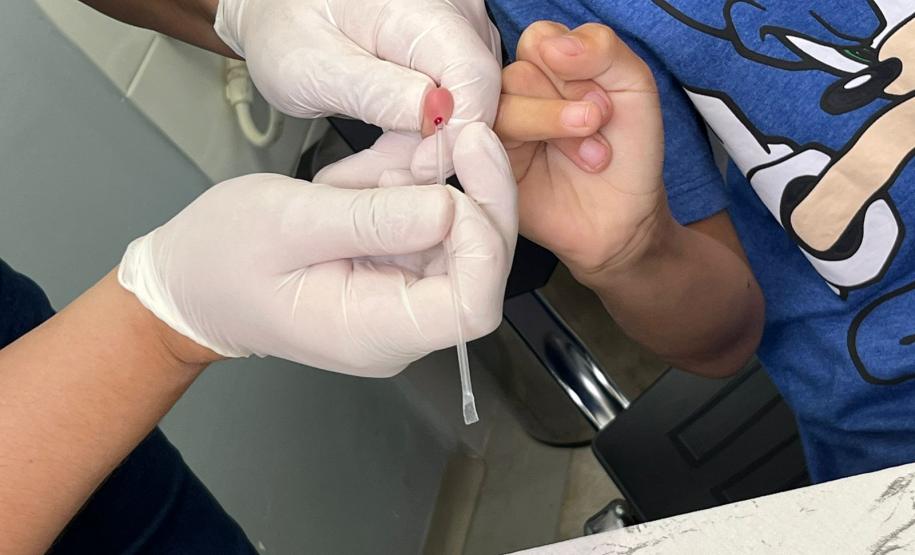 Estado reforça atenção para diagnóstico da hanseníase e luta contra o preconceito