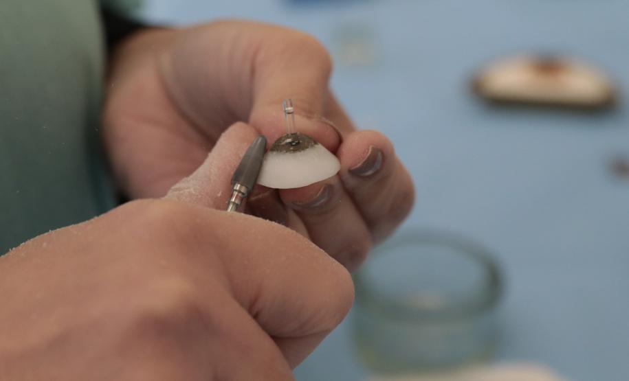 HR produz pelo SUS próteses faciais que recuperam autoestima dos pacientes